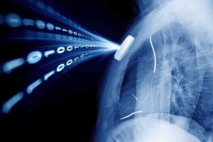 Collecting patient outcomes before and after implant insertion